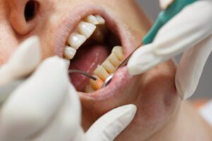Dental Treatment 1 300x200
